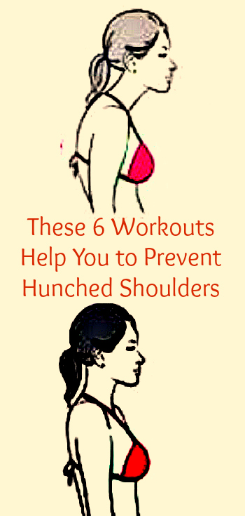 6 Workouts to Prevent Hunched Shoulders