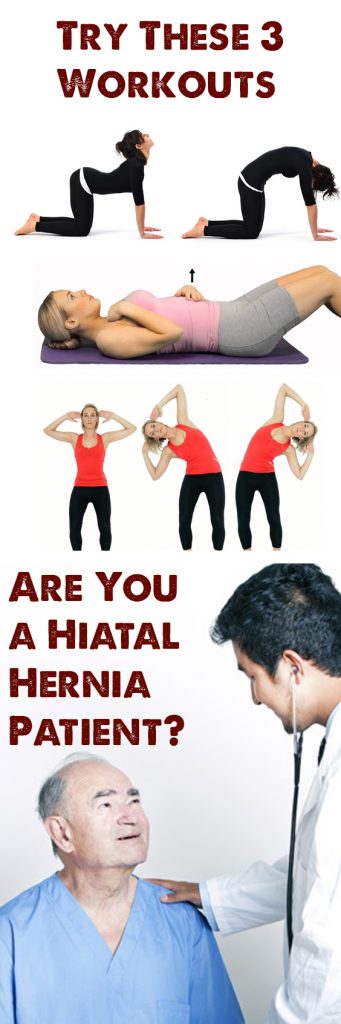 Are You A Hiatal Hernia Patient Try These 3 Workouts