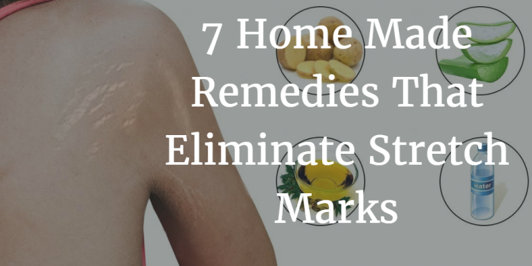 7 Home Made Remedies That Eliminate Stretch Marks 1