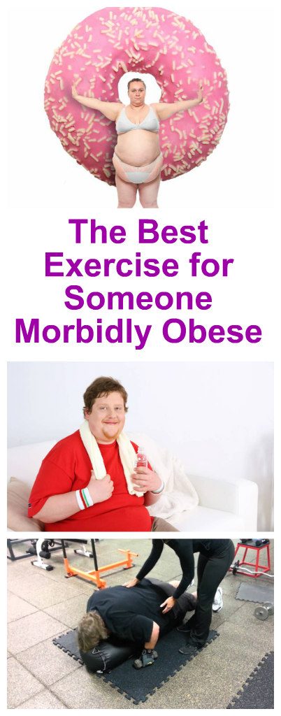 The Best Exercise for Someone Morbidly Obese 1