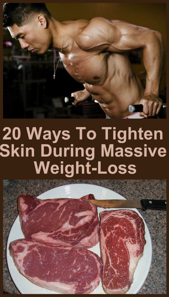 20-ways-to-tighten-skin-during-massive-weight-loss-new-1