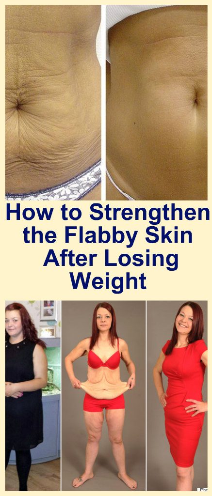 how-to-strengthen-the-flabby-skin-after-losing-weight-new1