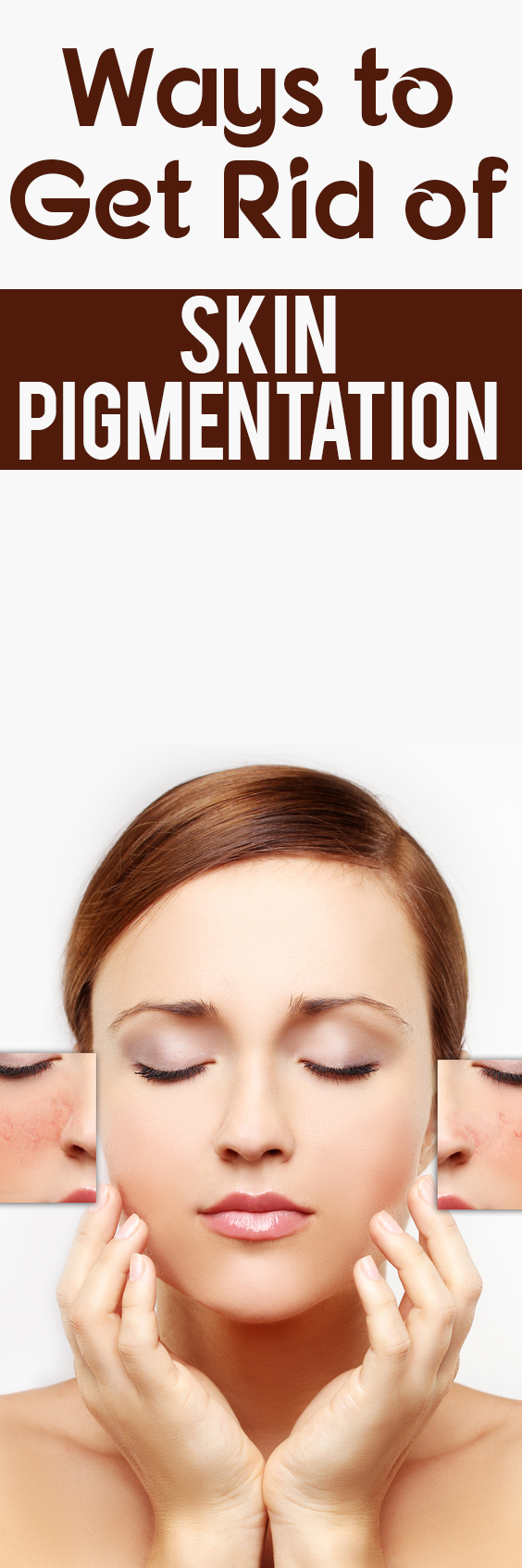 Ways to Get Rid of Skin Pigmentation