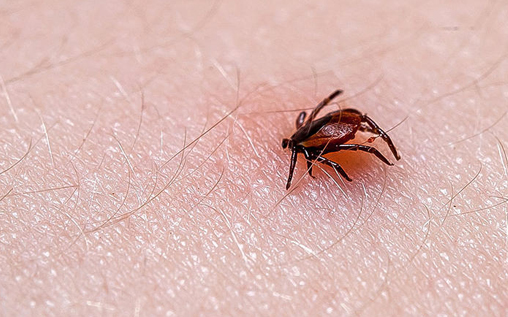 Lyme Disease and Its Symptoms