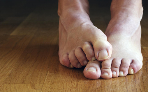 How to Prevent Smelly Feet