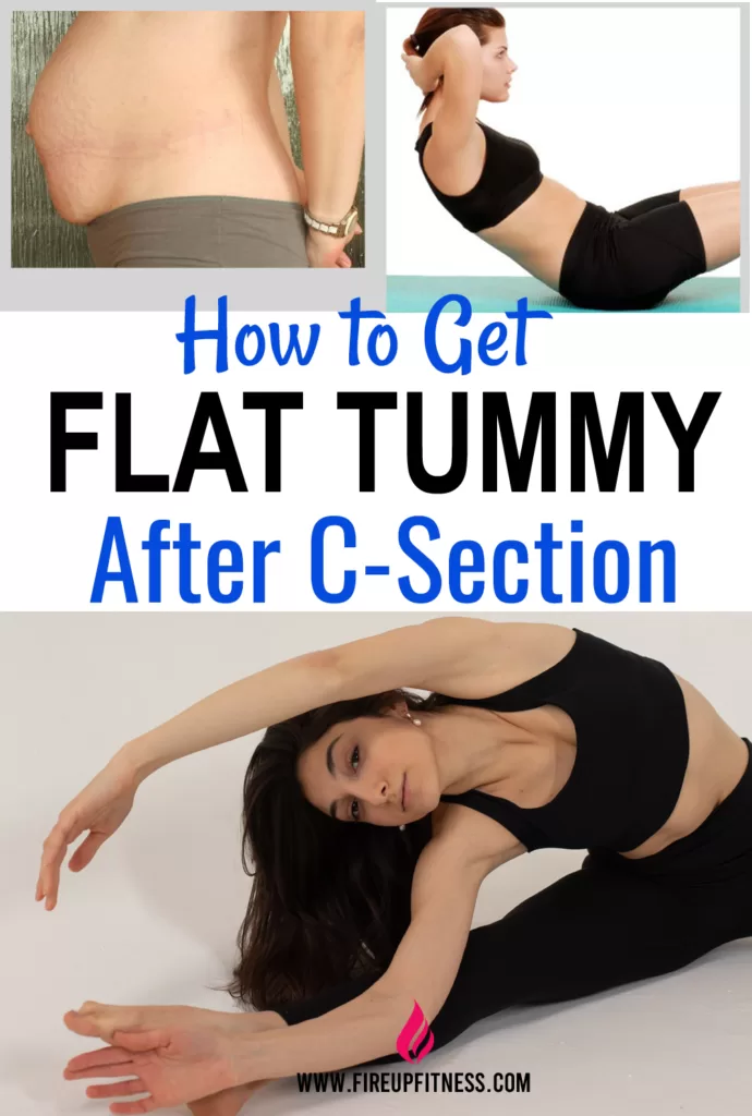 How to get a flat tummy after C-Section