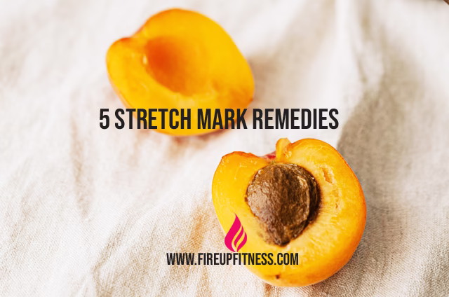 5 Stretch Mark Remedies That Actually Work